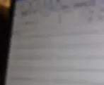 ECG