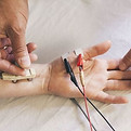 Estudio de VCN y EMG
