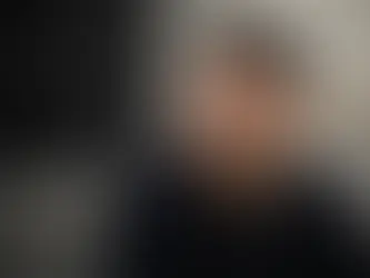 barba uomo per bilanciare stempiatura e fronte alta