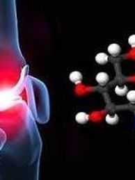 Artroglycan Inyectable Caja 5 X 10ml