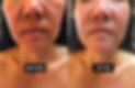massage facial_edited.jpg