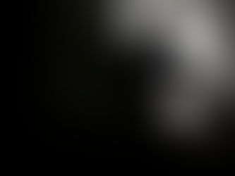 Endometriose: entenda o que é e qual o tratamento