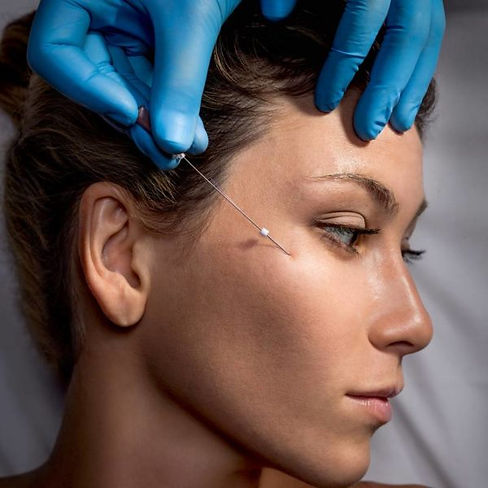 Tredlifting_niti_aptos_vallex-med.ru_800x800-600x600.jpg