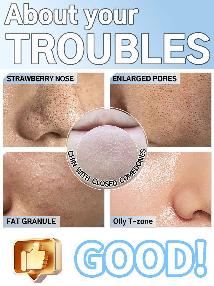 Thumbnail: 2025 New Upgrade Nose blackhead remover pimples and blackheads vacuum from the f