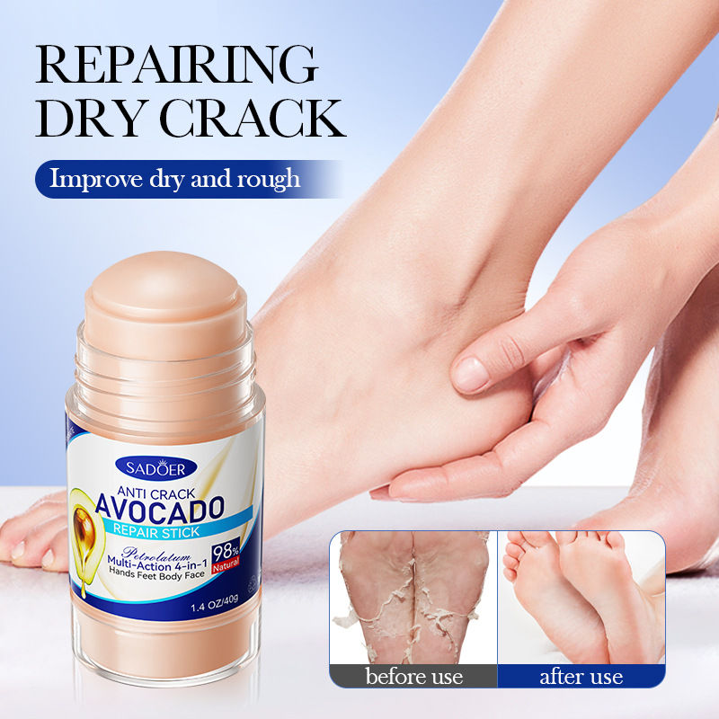 Thumbnail: Foot Cream Peach Essence Soften Heel Moisturizing Nourish Heel Stick Hand Feet C