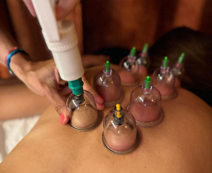 Cupping Thérapie Krystele Tacchi Thérapeute