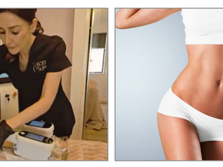 Advanced Fat Freezing Techniques in Australia: Laser Lipolysis Before Fat Freezing Explained