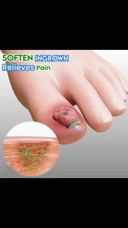 Toenail Repair Oil | Shopenzer, Inc.