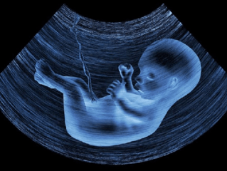 Legalização do aborto livre no STF: bispos brasileiros convidam à resistência
