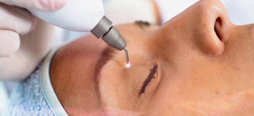 jato_de_plasma_blefaro_sem_corte_tratamento_estetico_ibramed.jpg