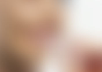 Invisalign is a Better Way to Get Awesome Smile!!!