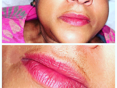 Dark lip tone lip tattooing…