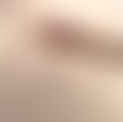 Review: Jan Pedinski – Barely Live at The Rubber Chicken - Melb Fringe