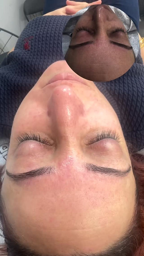 Ceylan Öner Güzellik Salonu — Hydrafacial cilt bakımı