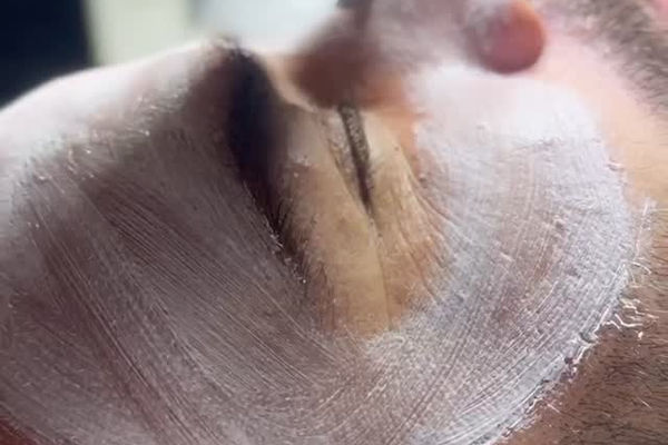 Milla Güzellik Merkezi — Cilt bakımı paylaşımı