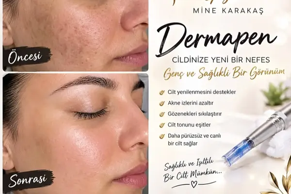 Bestmine Güzellik Merkezi — Cilt bakımı paylaşımı