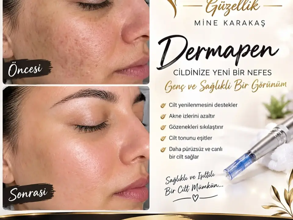 Bestmine Güzellik Merkezi — Cilt bakımı paylaşımı