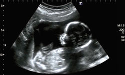 DRA. ALINE_ULTRASSONOGRAFIA