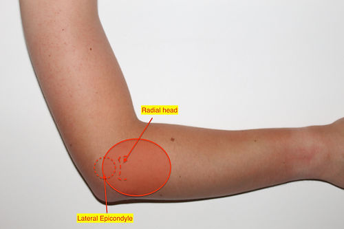 Radial head symptoms
