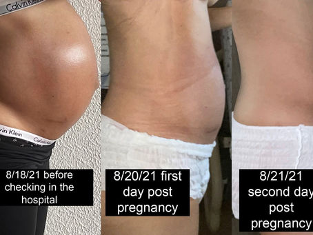 3 months Post Partum