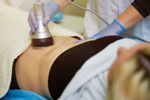 Ultrasound Fat Cavitation