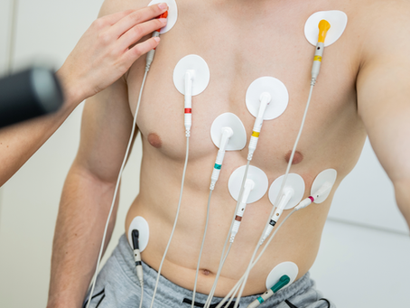ECG – PART I; SET UP AT REST AND FOR EXERCISE