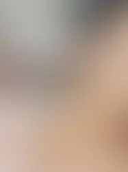 What to Expect in Your First Laser Hair Removal Visit