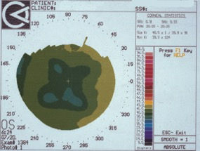 Ask a Test Scientist: Why Did My Quarterly Questions Score Change?
