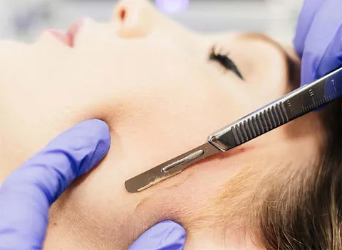 What is Dermaplaning