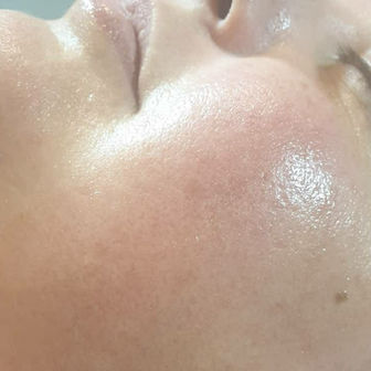 A Facial for the Fearless - Dermaplaning explained. 
