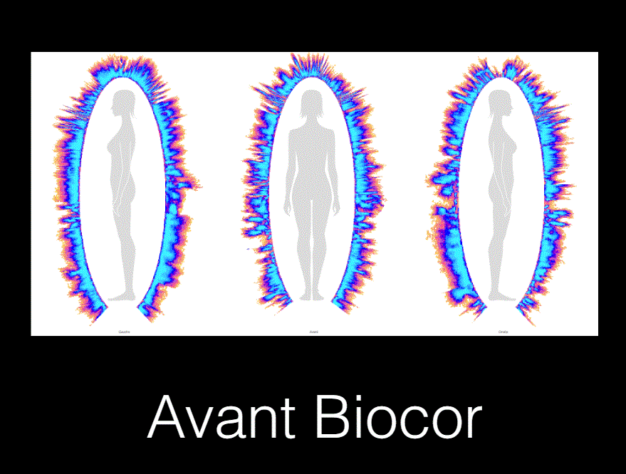 Avant Biocor.GIF