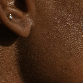 Four Areas You Might Forget to Apply Sunscreen