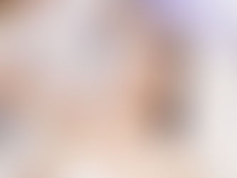 Laser Hair Removal for Unwanted Hair