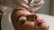 HydraFacial Cost in London: Is It Worth It?