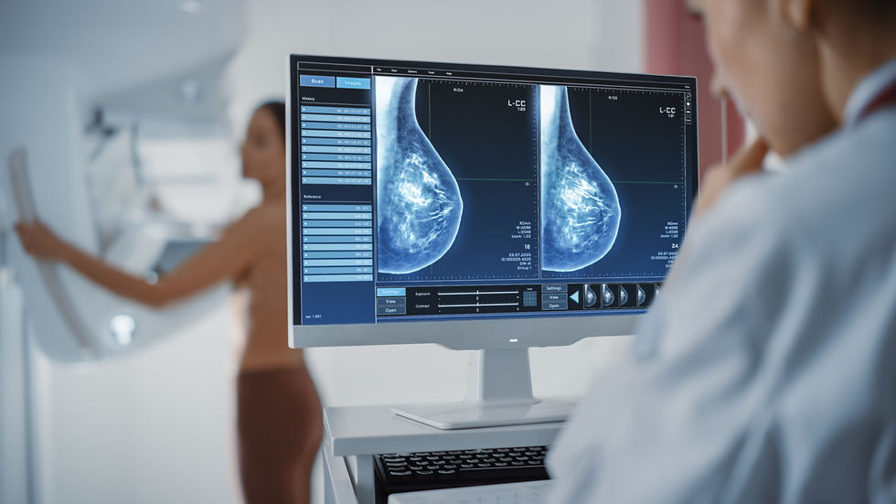 The Importance of High-Quality Mammography Imaging Technology in Breast Cancer Detection