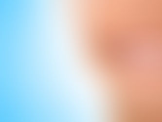 Facetas de resina: 7 cuidados para mantê-las sempre novas