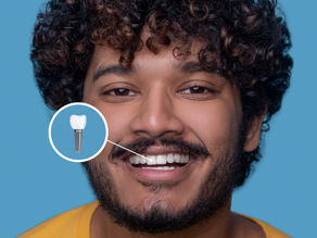 Não confunda implante dental com coroas