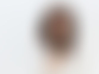 Socorro! Estou com dentes moles. Conheça as principais causas e tratamentos para a doença