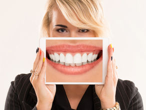 Conheça as diferenças entre clareamento e branqueamento dental