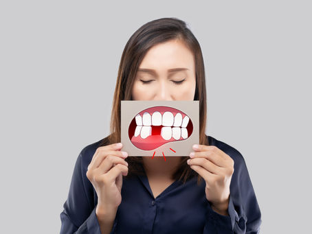 Ausência de dentes: Entenda o impacto disso para a sua saúde