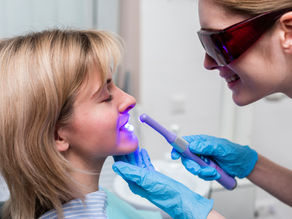 6 coisas que você precisa saber sobre clareamento dental