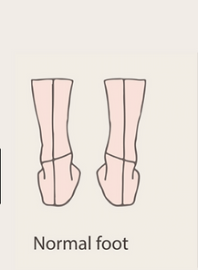 Variations - Straight Feet