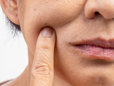 The Most Profitable Beauty Treatment Investment with Collagen