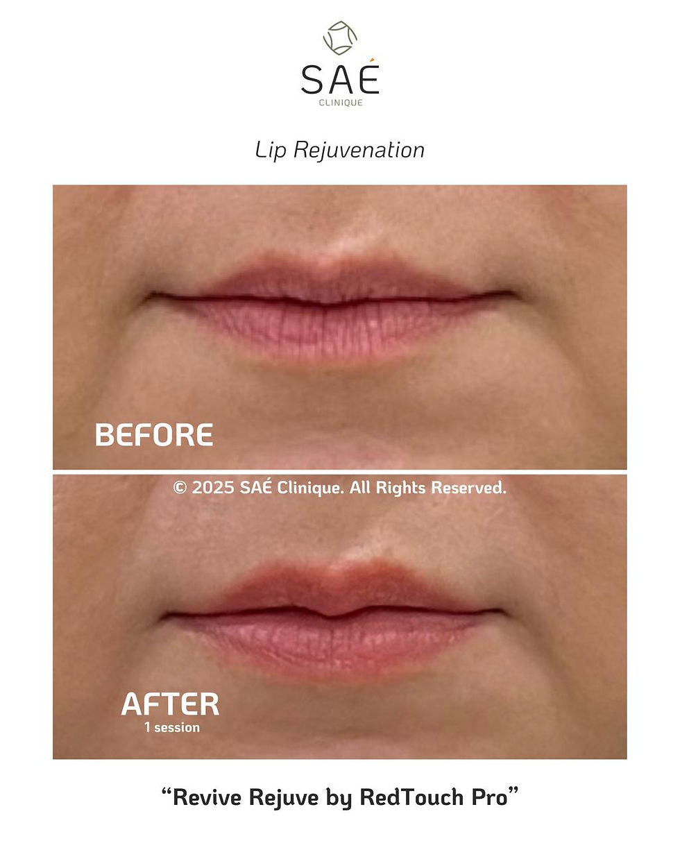 Close-up dari bibir, sebelah kiri kering dan pucat, sebelah kanan lembap dan merah muda. Menunjukkan efek sebelum dan sesudah perawatan. 