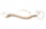 Spinal Conditions Neurosurgeon in St. Louis - Kumar Vasudevan, MD