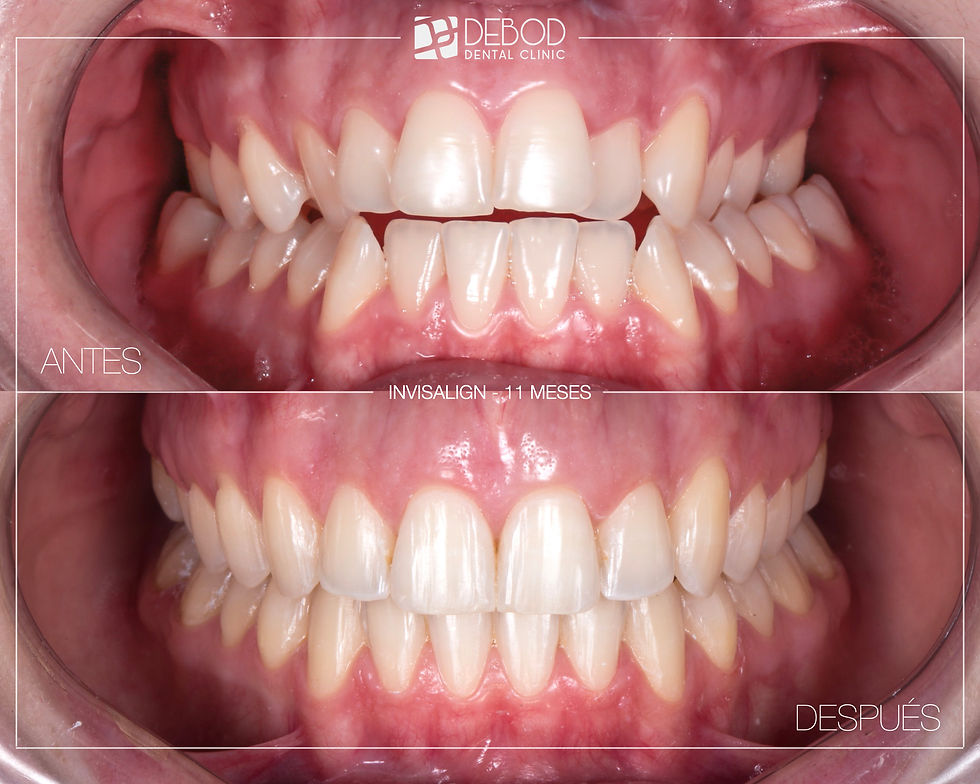 Ortodoncista en Argüelles, Madrid - Debod Dental Clinic