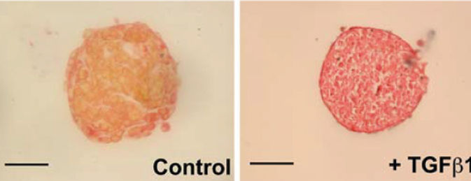 Staining of the muscular and ECM components of cardiac spheroids
