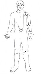 Fascia Pulley System