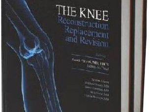 The most common reason for knee replacement surgery is to ease pain caused by arthritis