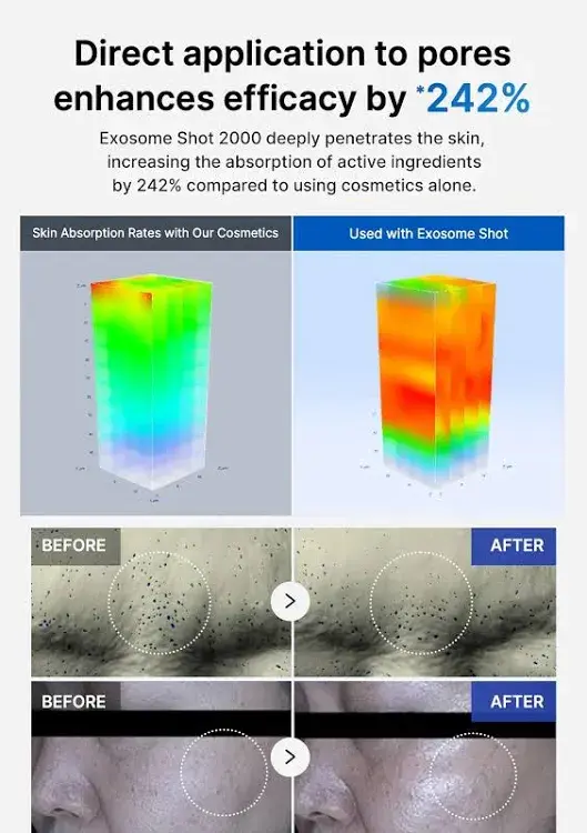 Thumbnail: Medicube Exosome Shot Pore Serum 7500